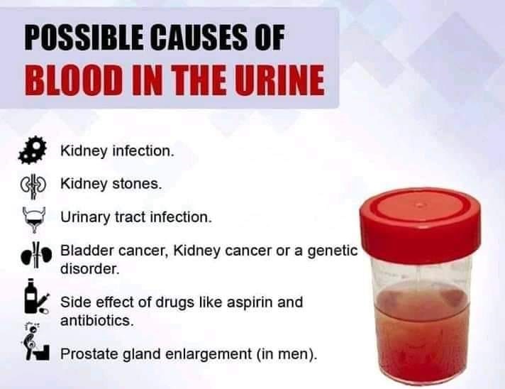 ayurvedic-medicine-to-reduce-blood-urea